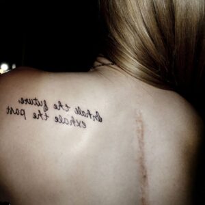 Dos nu blonde avec tatouage a Saint Omer et cicatrice